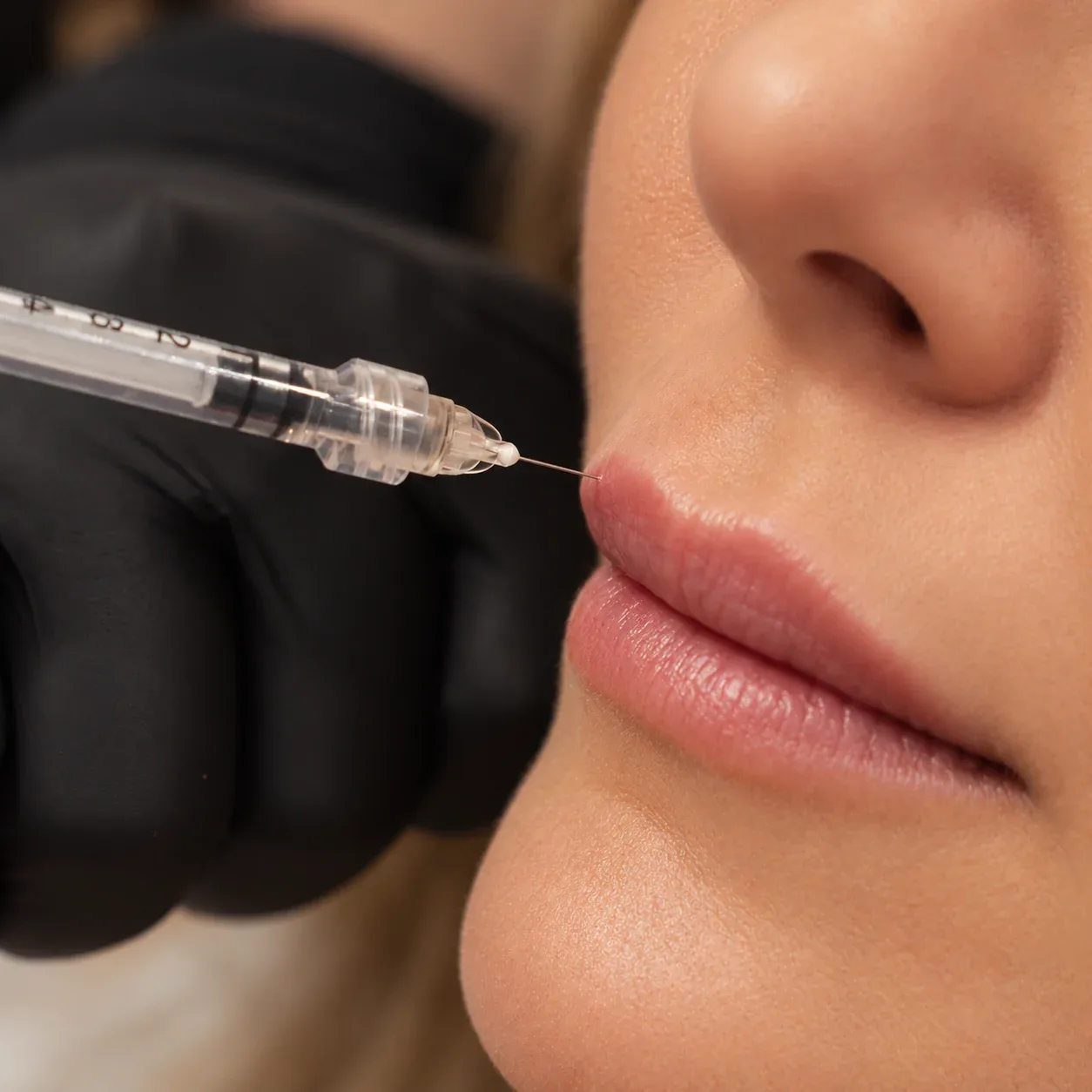 A fine injection needle is positioned at the border of a woman's upper lip.